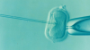 Rusza tegoroczny nabór do programu leczenia niepłodności metodą in vitro